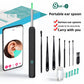 Visual Ear Scoop with HD Camera